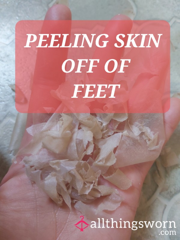 Foot Peeling Pulling Photos