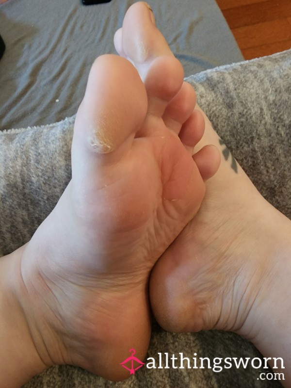 My Foot Shavings After A 2 Mile Hike, With Video